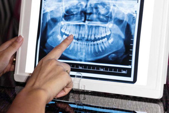 Radiologia